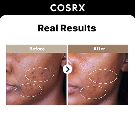 COSRX 2% Alpha Arbutin Face Serum