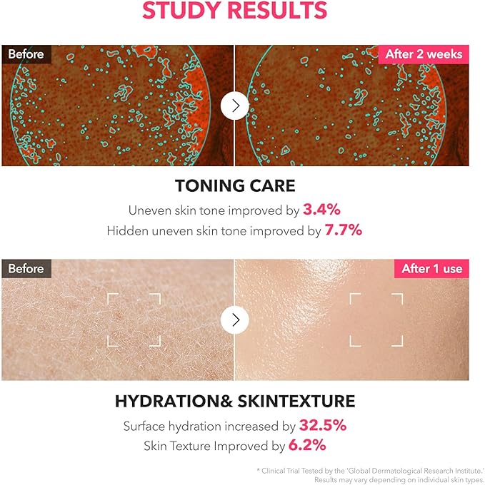 APRILSKIN TXA+Niacinamide 99 Pink Milky Toner