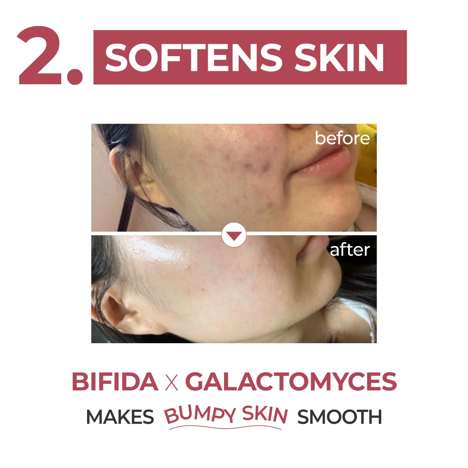 Numbuzin No.3 Serum | Skin Softening Serum - Image 3