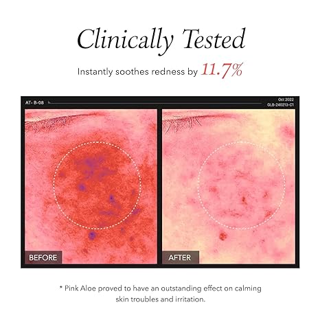 APRILSKIN Pink Aloe Facial Polish Cleanser - Image 5