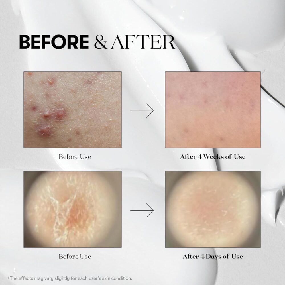 VT COSMETICS CICA Reedle Shot 700 | Spicule Microneedling Serum 30ml - Image 3