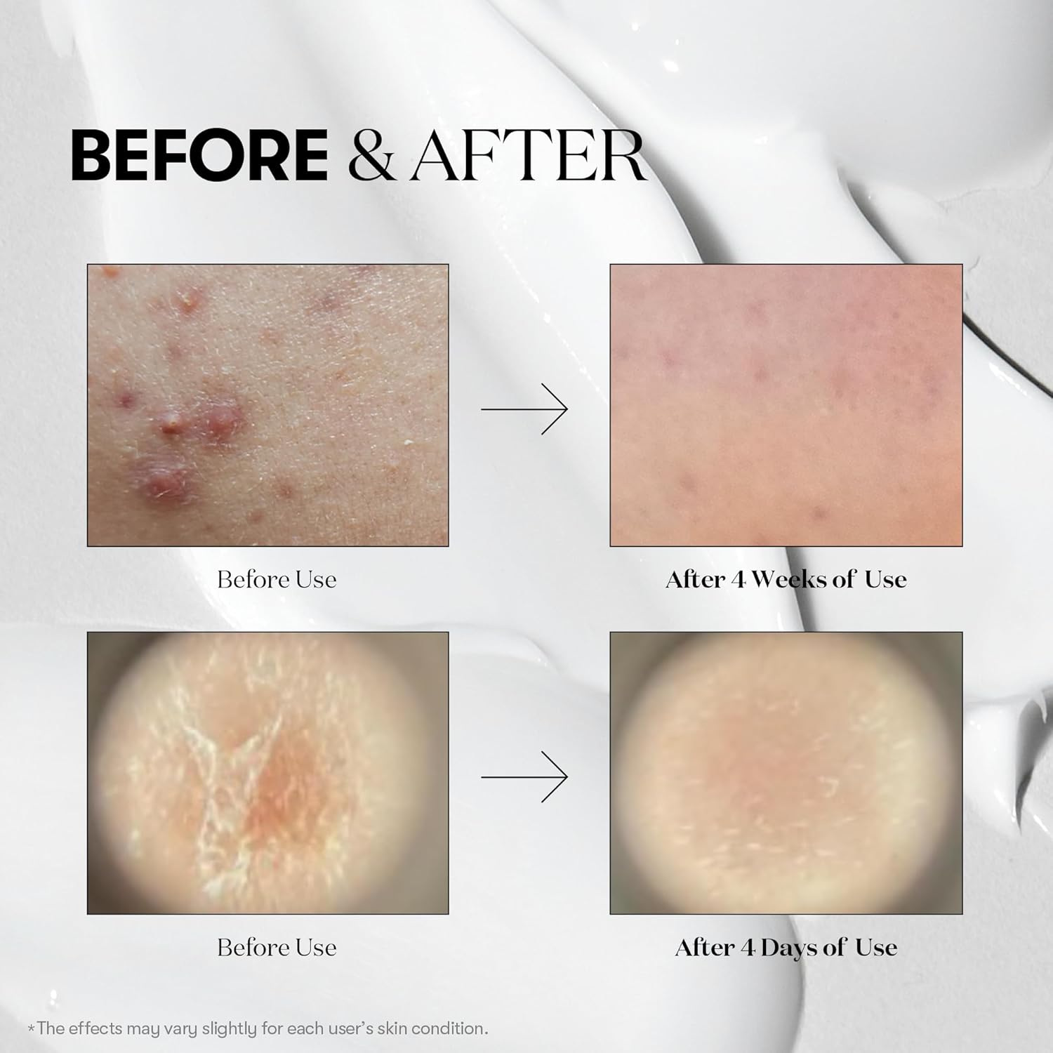 VT COSMETICS CICA Reedle Shot 700 | Spicule Microneedling Serum 30ml - Image 3