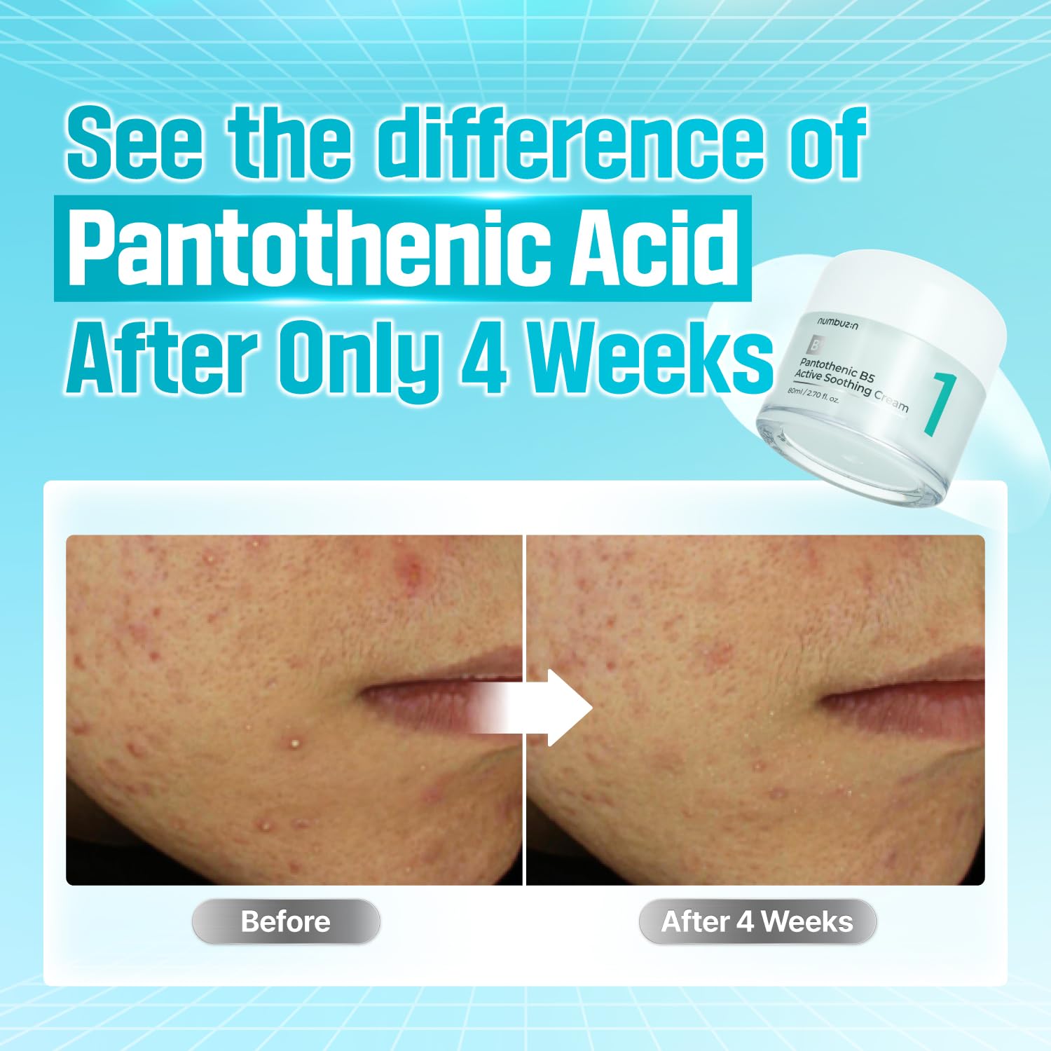 Numbuzin No.1 Cream | Pantothenic B5 Active Soothing Cream | - Image 5