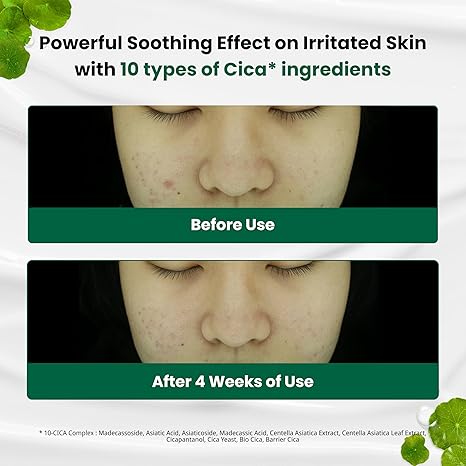 Dr. G Red Blemish Clear Cream 70ml - Image 3