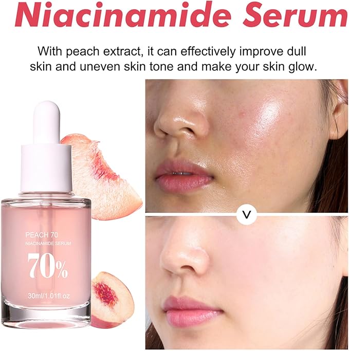 Anua Peach 70 Niacin Serum - Image 7