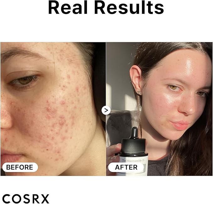 Cosrx The Niacinamide 15 Face serum - Image 3