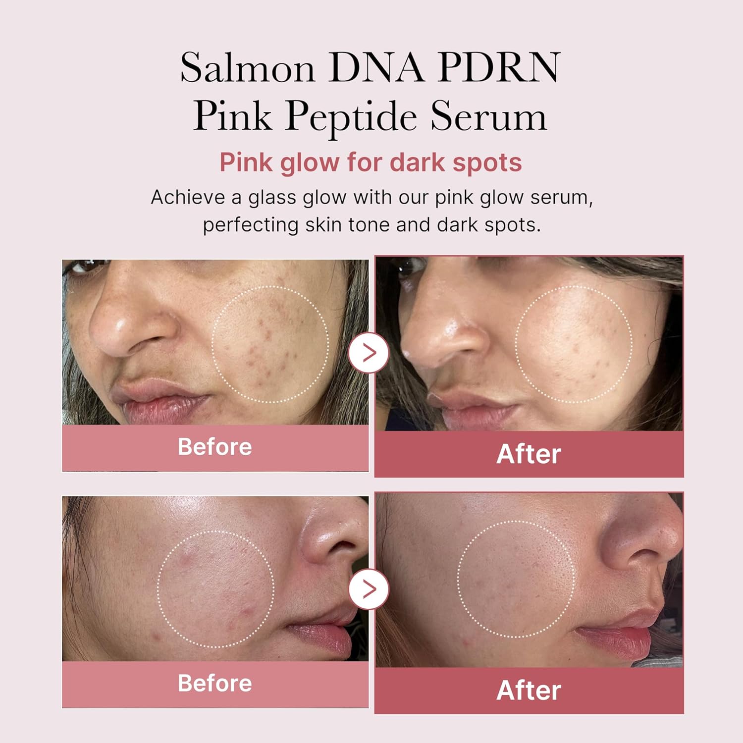 medicube PDRN Pink Peptide Serum 30ml - Image 4